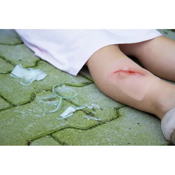 Εκπαιδευτικό Ομοίωμα Τραύματος από Γυάλινο Θραύσμα Εκπαιδευτικό Ομοίωμα Τραύματος από Γυάλινο Θραύσμα