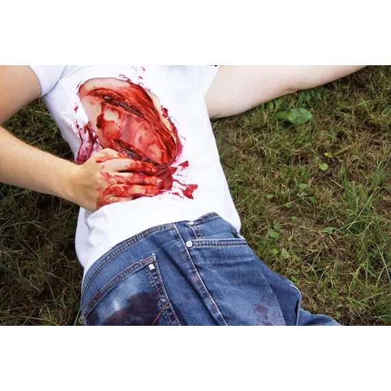 Εκπαιδευτικό Ομοίωμα Μεγάλου Κοψίματος με Λειτουργία Αιμορραγίας Εκπαιδευτικό Ομοίωμα Μεγάλου Κοψίματος με Λειτουργία Αιμορραγίας