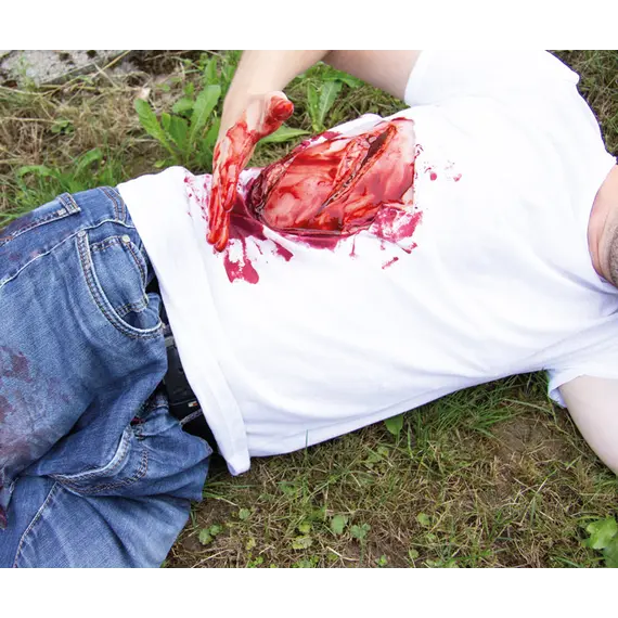 Εκπαιδευτικό Ομοίωμα Μεγάλου Κοψίματος με Λειτουργία Αιμορραγίας Εκπαιδευτικό Ομοίωμα Μεγάλου Κοψίματος με Λειτουργία Αιμορραγίας